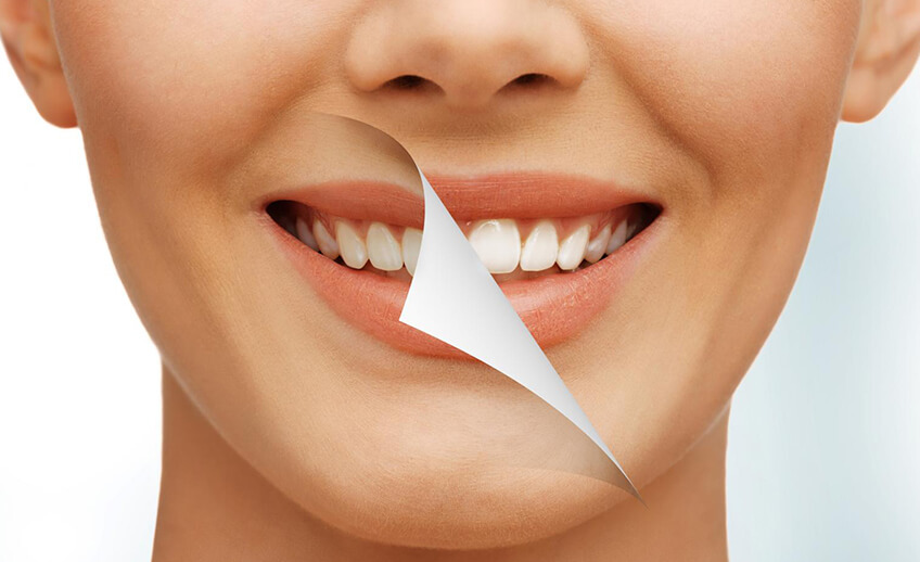 3 روش خانگی برای داشتن دندان های سفید